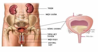 viêm bàng quang ở nam giới là gì