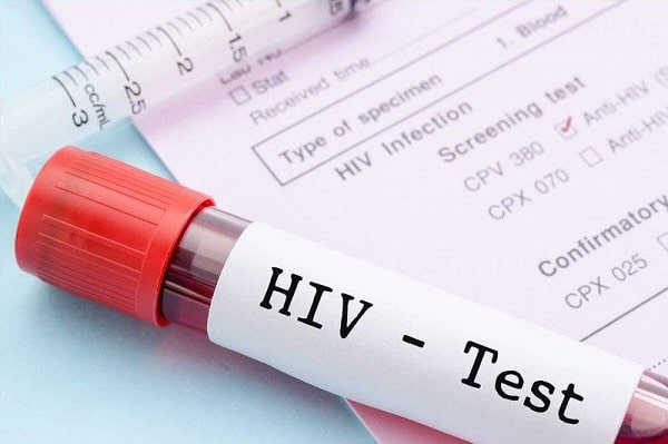 Giang mai và HIV