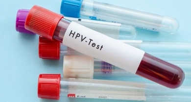 xét nghiệm hpv là gì