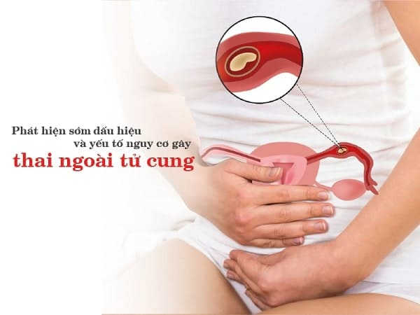 nạo phá thai nguyên nhân do đâu