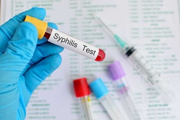 Test Syphilis là gì