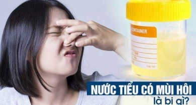 Nước tiểu có mùi hôi chữa dứt điểm cùng chuyên gia 7 nước tiểu có mùi hôi là bị gì